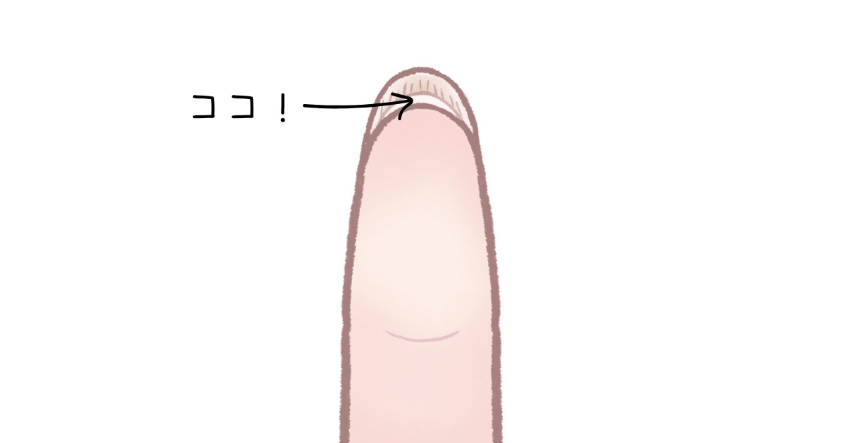 爪ケア