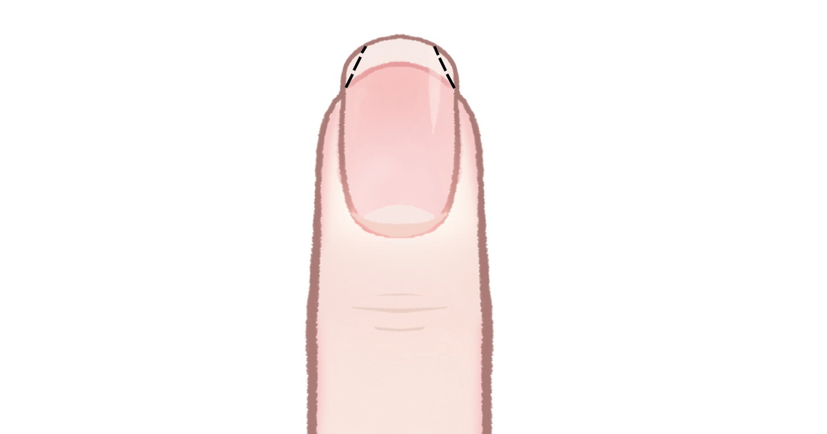 爪ケア